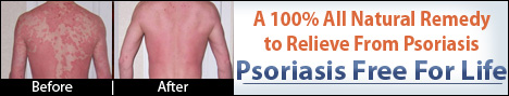 Psoriasis Free For Life Guide